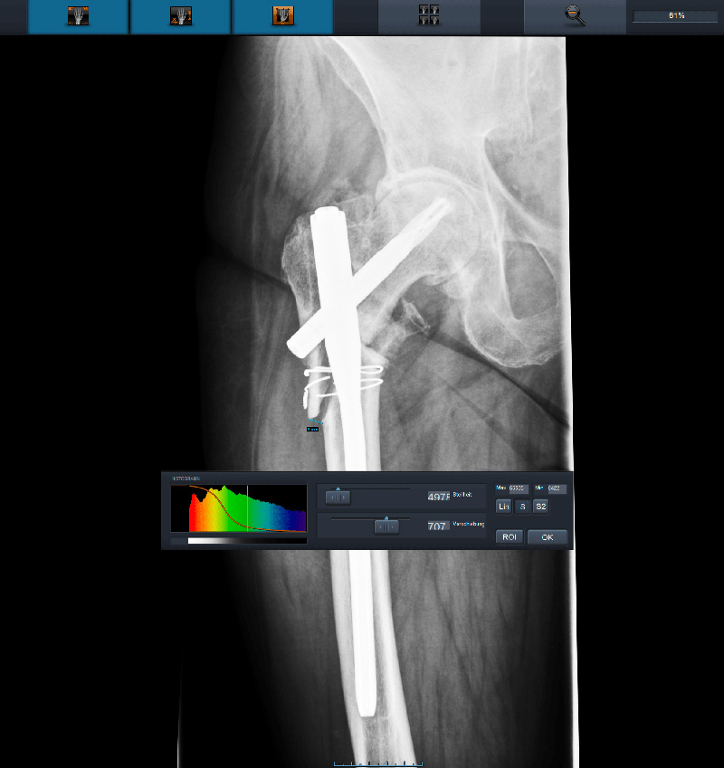 Röntgenbild zur Diagnostik bei der Orthopädie Dr. Ziolko in Köln