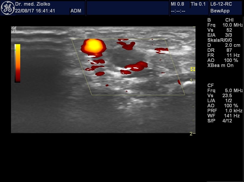 Ultraschallbild bei der Orthopädie Dr. Ziolko in Köln
